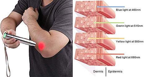 best red light therapy device