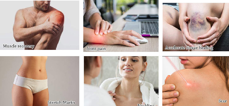 Incredible Uses for Red Light Therapy at Home